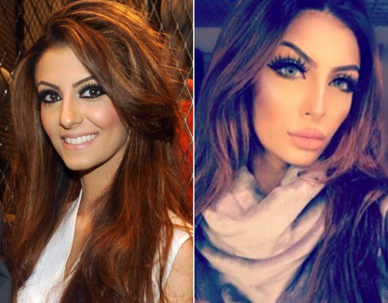 Faryal Makhdooms Shocking Pictures Of Before And After Cosmetic Surgery Reviewitpk 