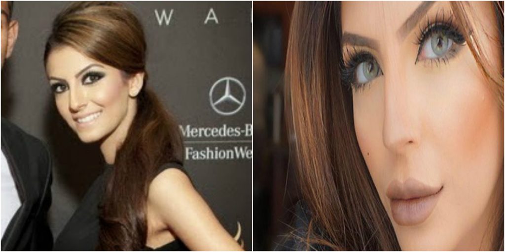 Faryal Makhdoom's shocking pictures of Before & After Cosmetic Surgery