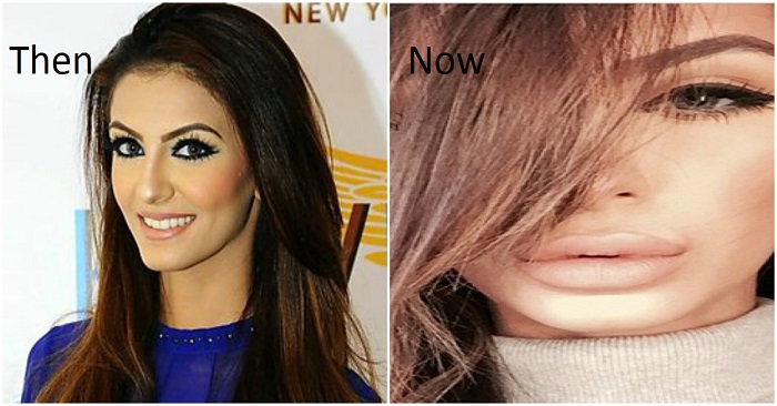 Faryal Makhdoom's shocking pictures of Before & After Cosmetic Surgery