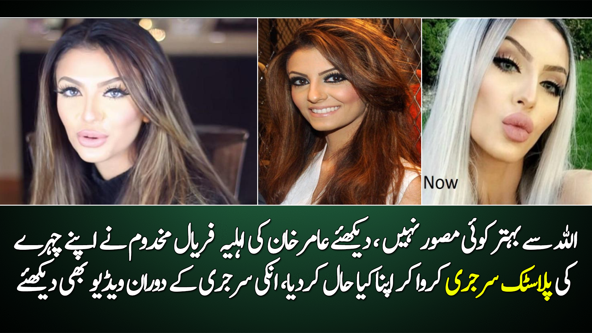 Faryal Makhdooms Shocking Pictures Of Before And After Cosmetic Surgery Reviewitpk 