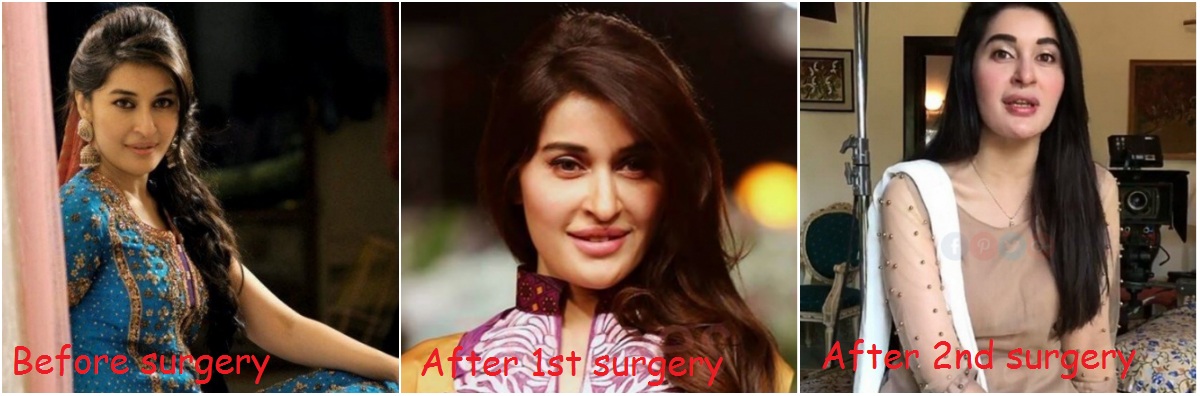 Shaista Lodhi Before & After Cosmetic Surgeries!