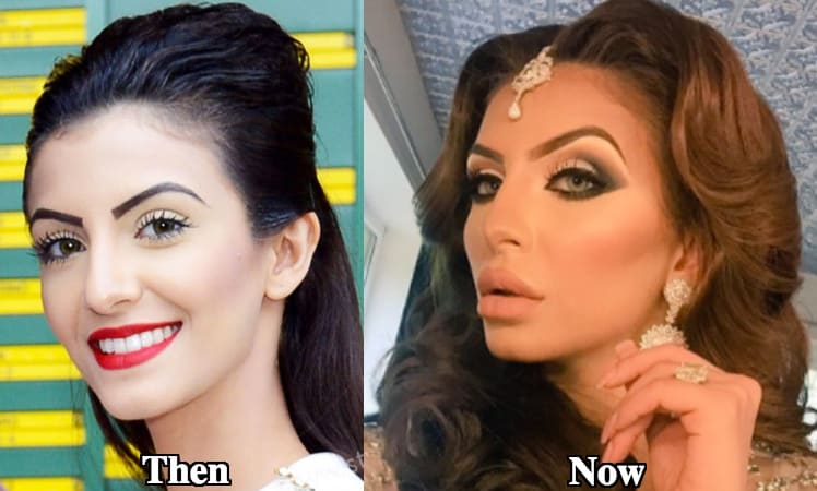 I Do Not Have Any Surgeries Done: Faryal Makhdoom!