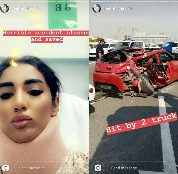 Mathira Met With A Car Accident