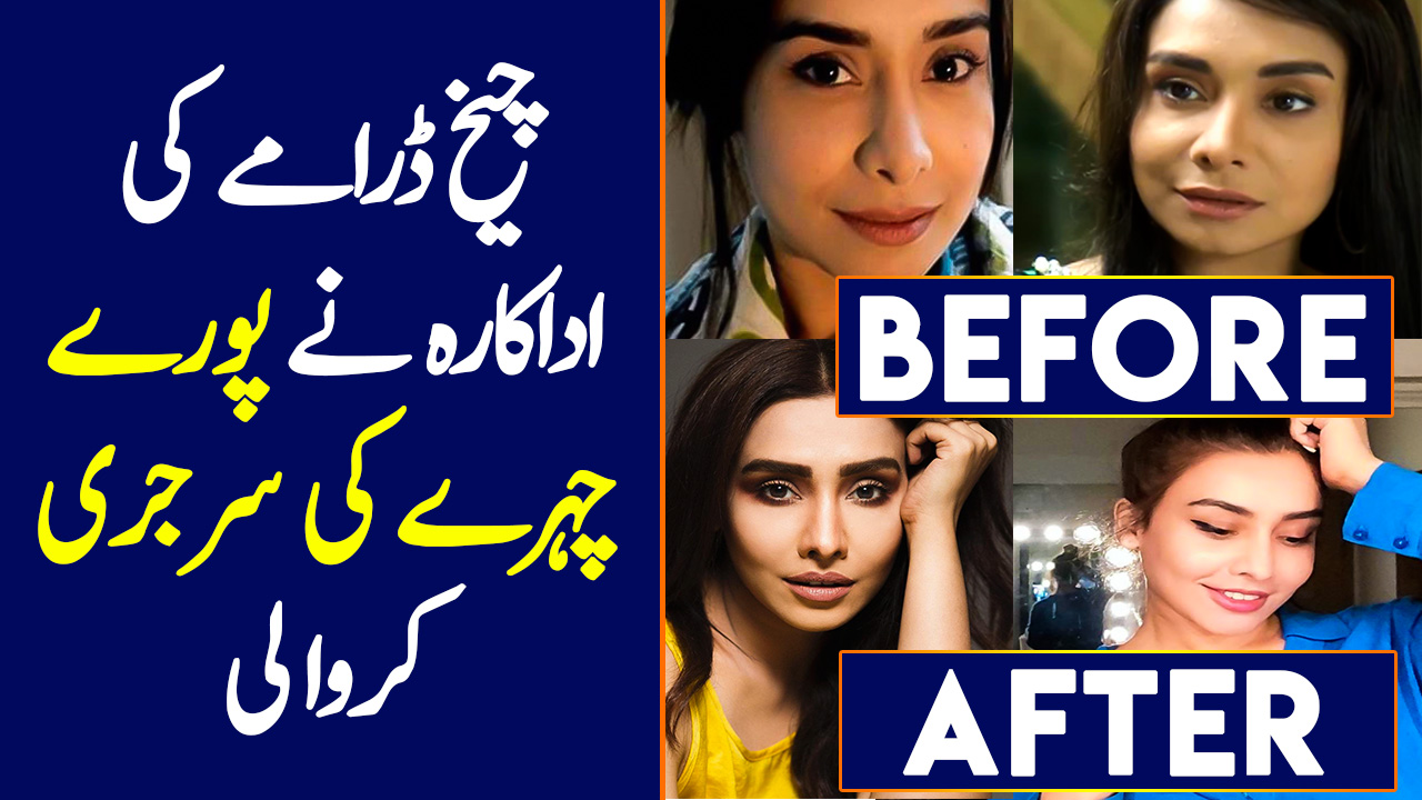 Maira Khan's Before and After Plastic Surgery Pictures
