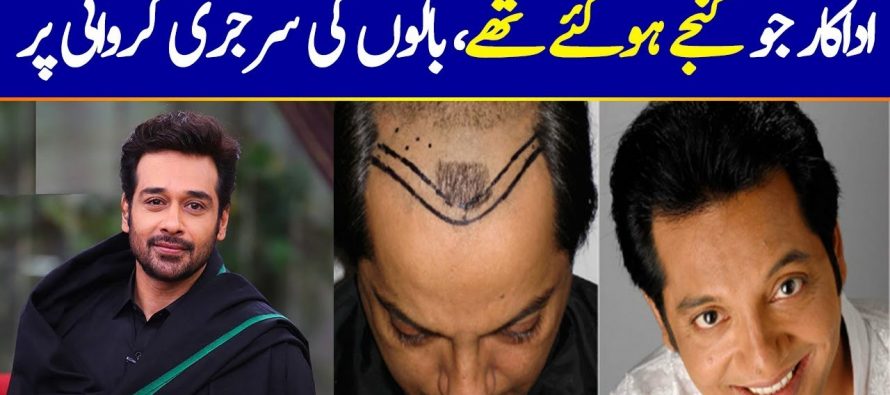 Pakistani Celebrities Who Got Hair Transplant