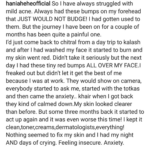 Hania Aamir Talks About Skin Insecurities