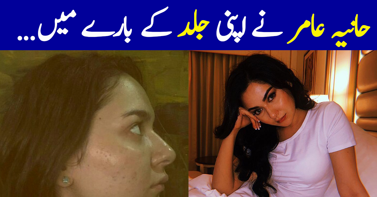 Hania Aamir Talks About Skin Insecurities