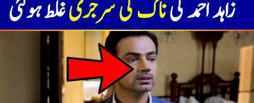 Zahid Ahmed Nose Surgery Gone Wrong