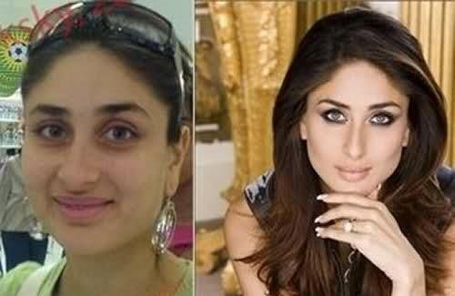Bollywood Actresses Transformation through Facial Surgeries - 2020