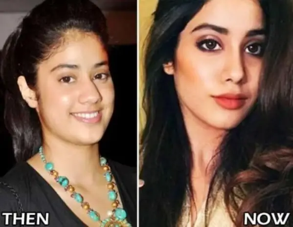 Bollywood Actresses Transformation through Facial Surgeries - 2020