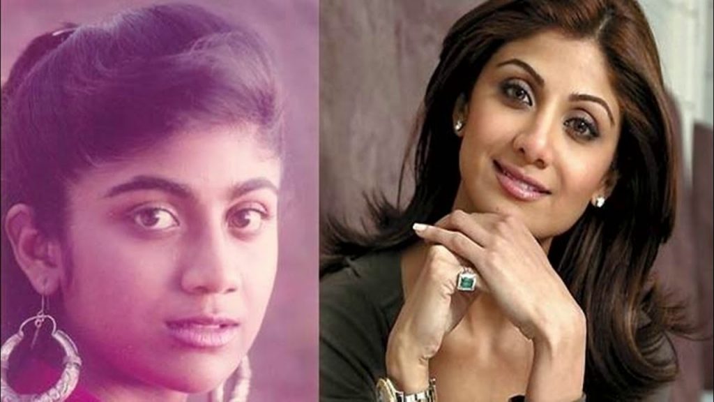 Bollywood Actresses Transformation through Facial Surgeries - 2020