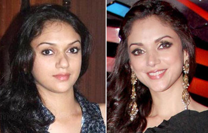 Bollywood Actresses Transformation through Facial Surgeries - 2020