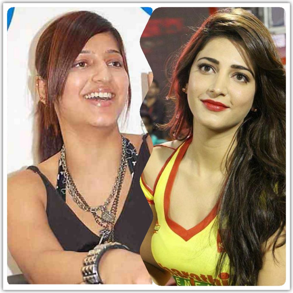 Bollywood Actresses Transformation through Facial Surgeries - 2020