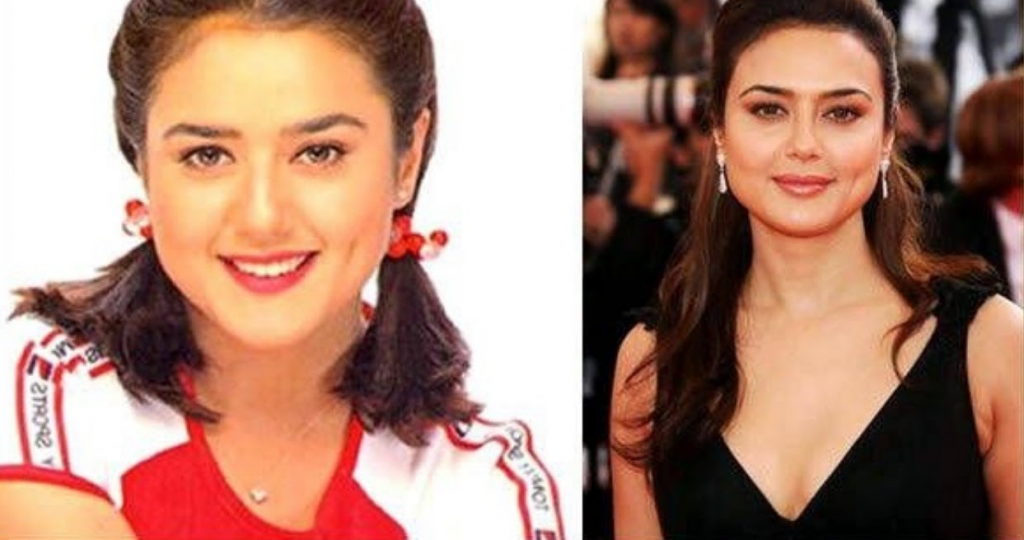 Bollywood Actresses Transformation through Facial Surgeries - 2020