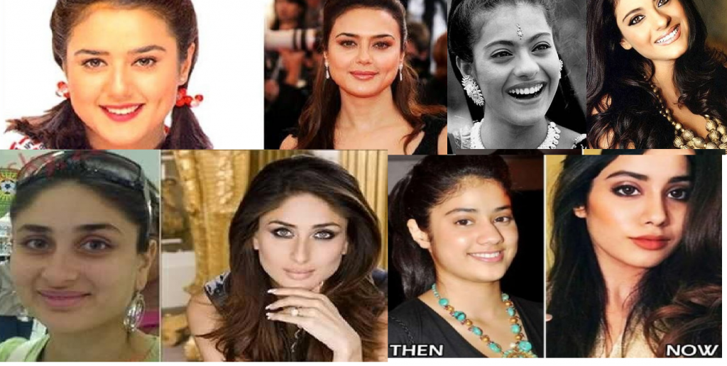 Bollywood Actresses Transformation through Facial Surgeries - 2020