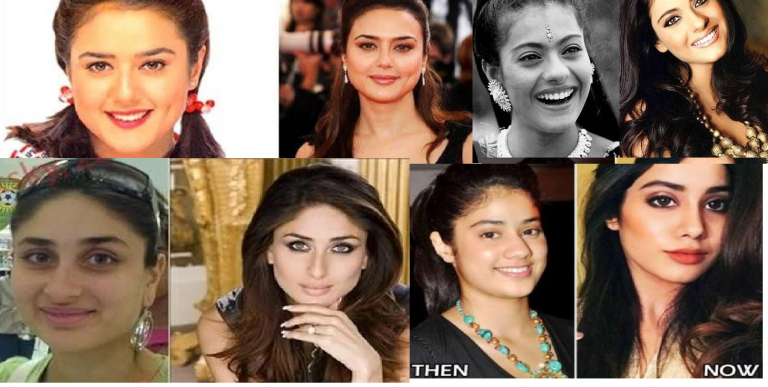 Bollywood Actresses Transformation through Facial Surgeries – 2020