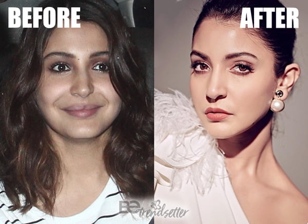 Bollywood Actresses Transformation through Facial Surgeries - 2020