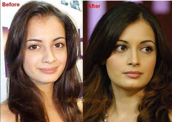 Bollywood Actresses Transformation through Facial Surgeries - 2020