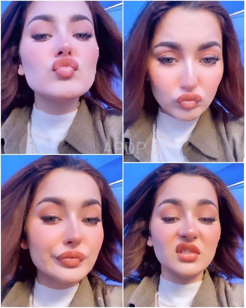 Hania Aamir Had Lip Fillers And People Can't Digest It