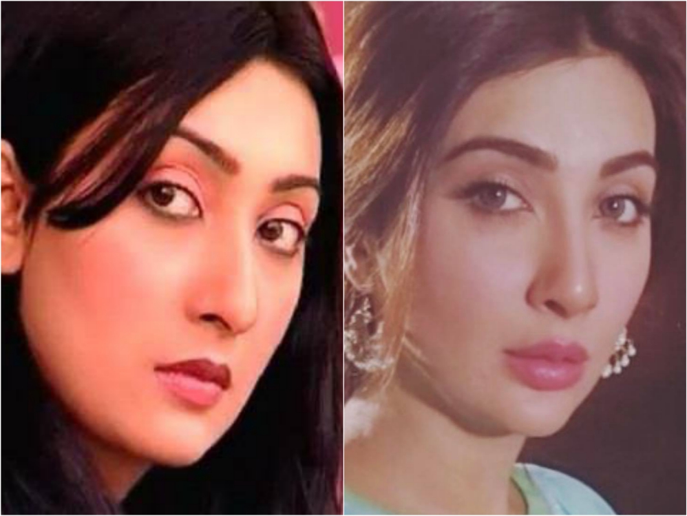 Pakistani Actresses Who Got Lip Fillers Done