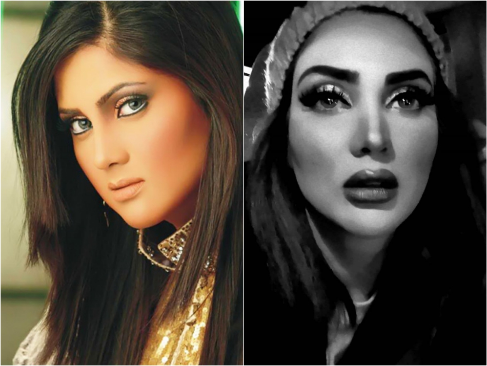 Pakistani Actresses Who Got Lip Fillers Done