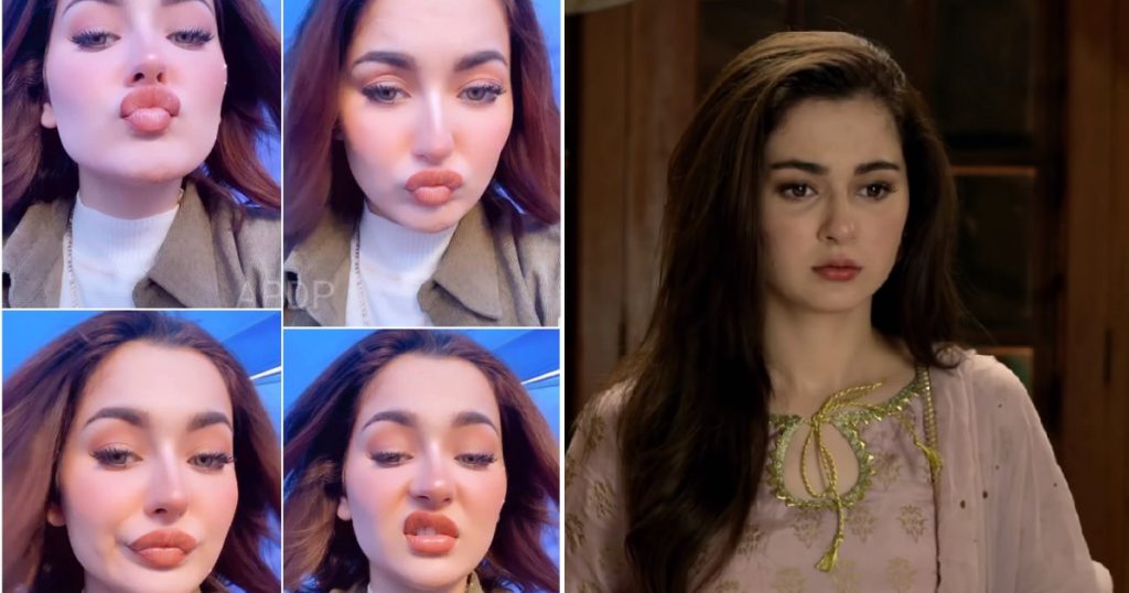 Hania Aamir Had Lip Fillers And People Can't Digest It