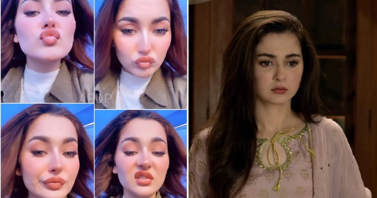Hania Aamir Had Lip Fillers And People Can’t Digest It