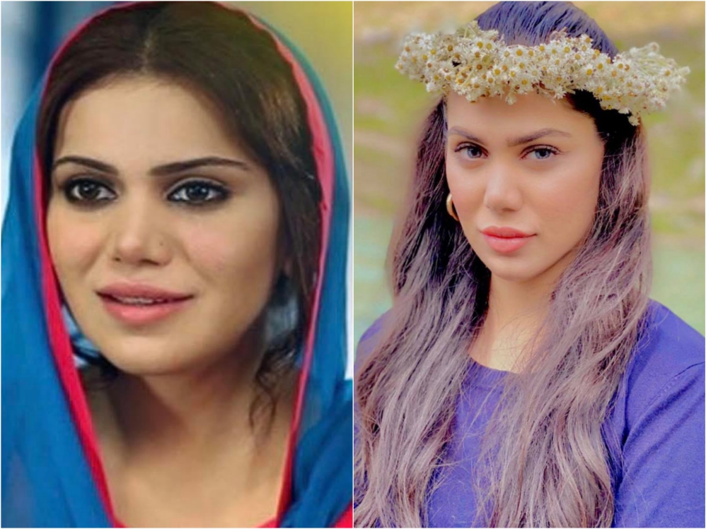 Pakistani Celebrities Before and After Nose Surgery