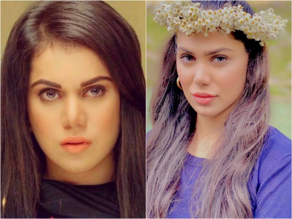 Pakistani Actresses Who Got Lip Fillers Done