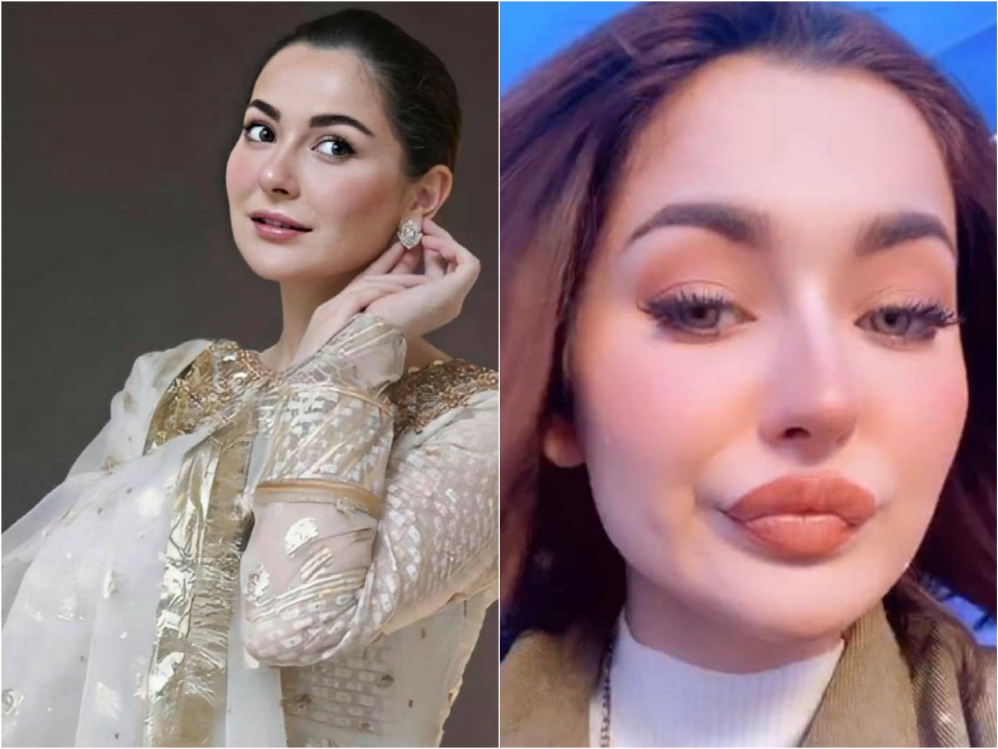 Pakistani Actresses Who Got Lip Fillers Done