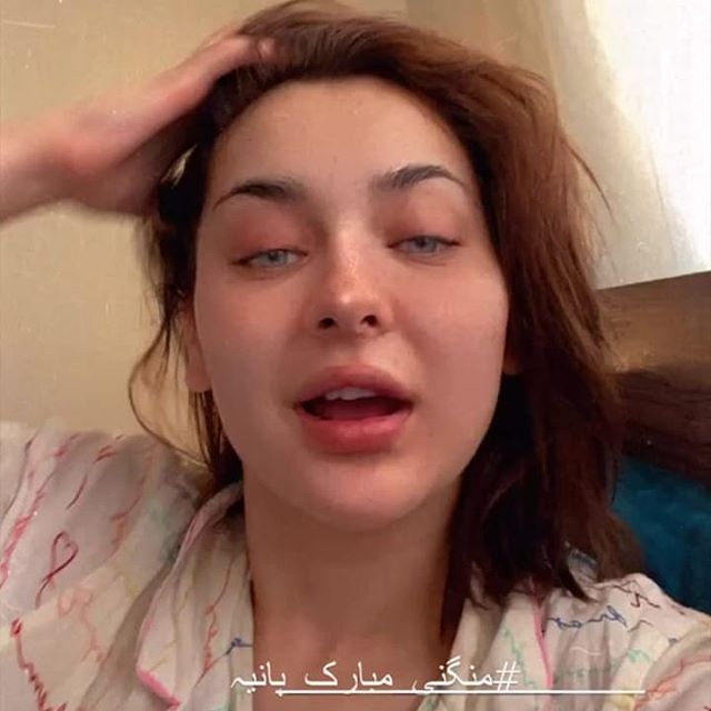 Hania Aamir Revealed The Reality Behind Her Big Lips