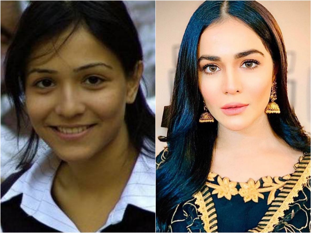 Pakistani Celebrities Before and After Nose Surgery