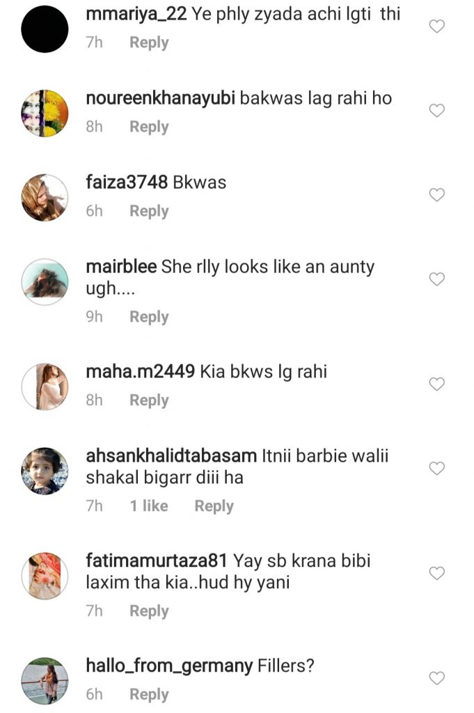 Hania Aamir Had Lip Fillers And People Can't Digest It
