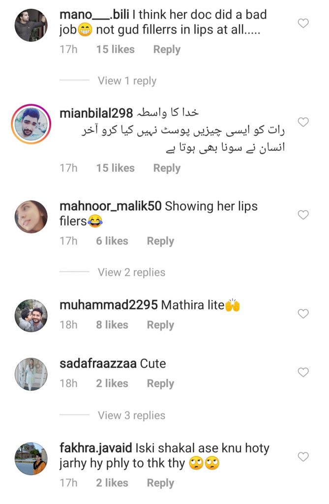 Hania Aamir Had Lip Fillers And People Can't Digest It