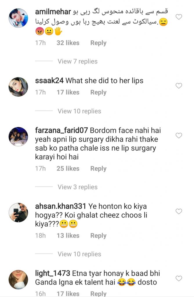 Hania Aamir Had Lip Fillers And People Can't Digest It