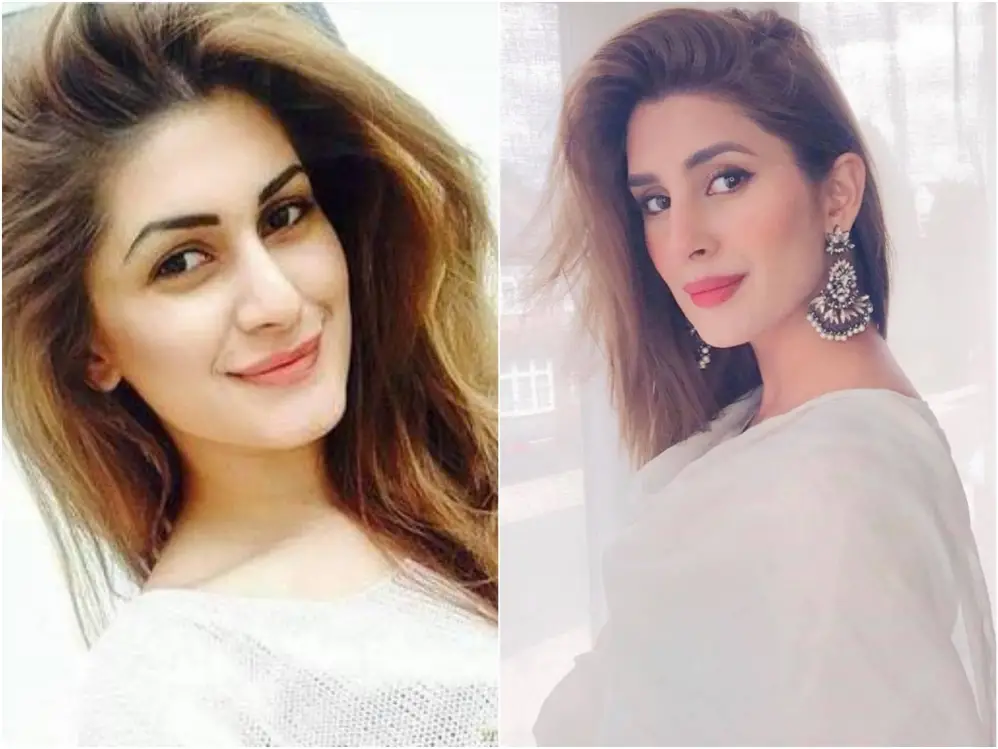 Pakistani Actresses Who Got Lip Fillers Done