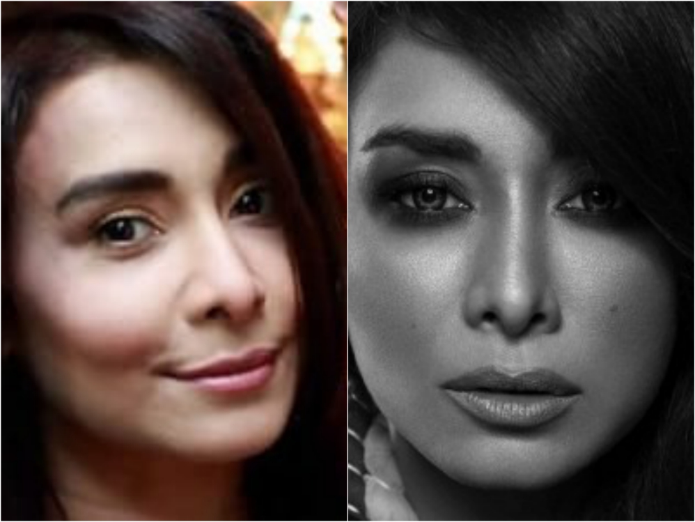 Pakistani Actresses Who Got Lip Fillers Done