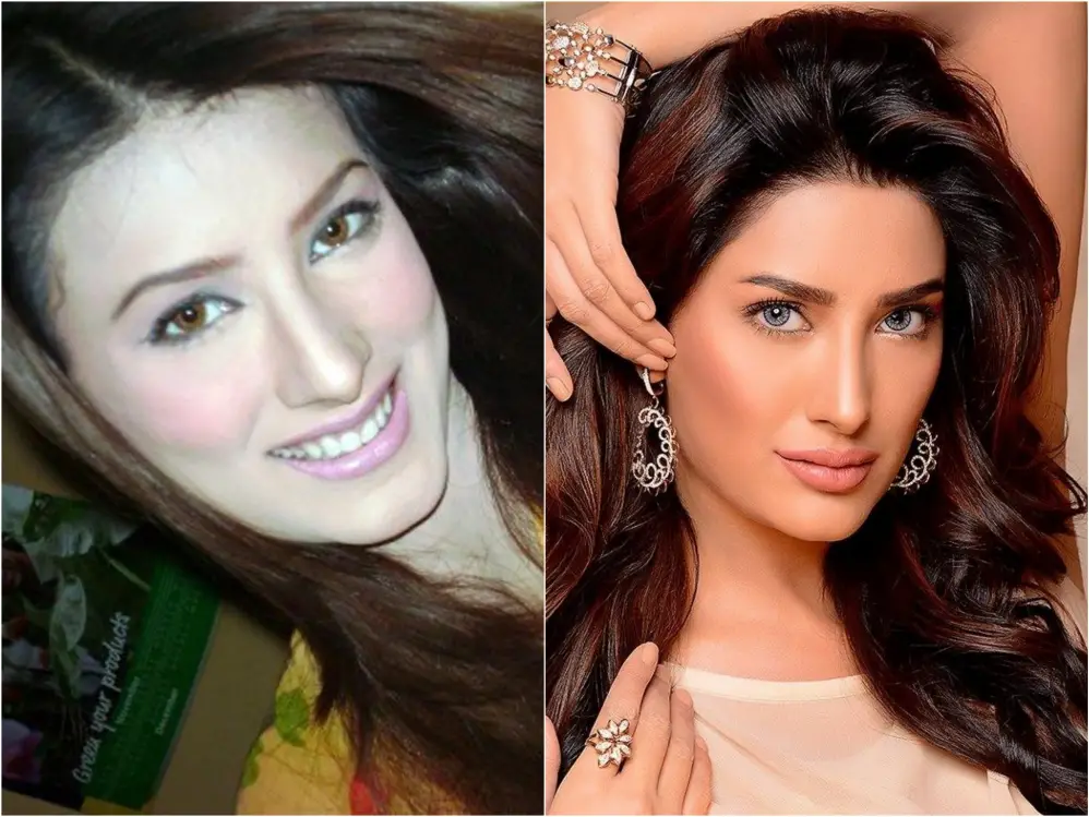 Pakistani Actresses Who Got Lip Fillers Done