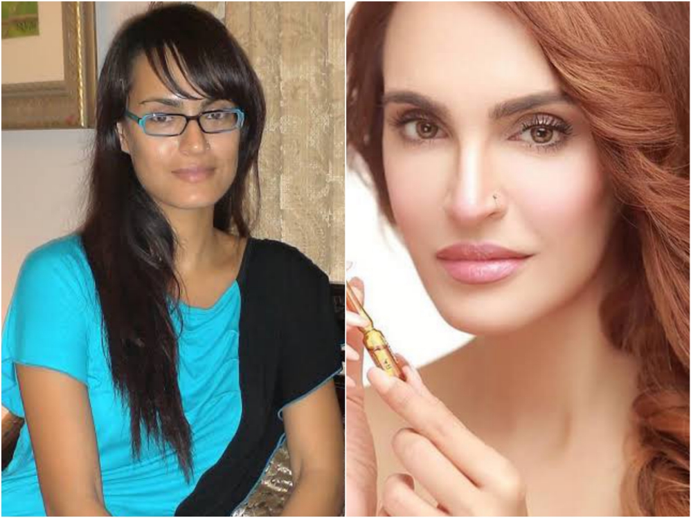 Pakistani Actresses Who Got Lip Fillers Done