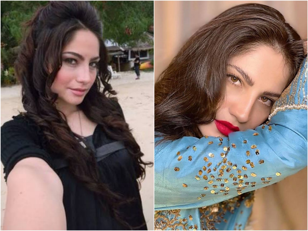 Pakistani Actresses Who Got Lip Fillers Done