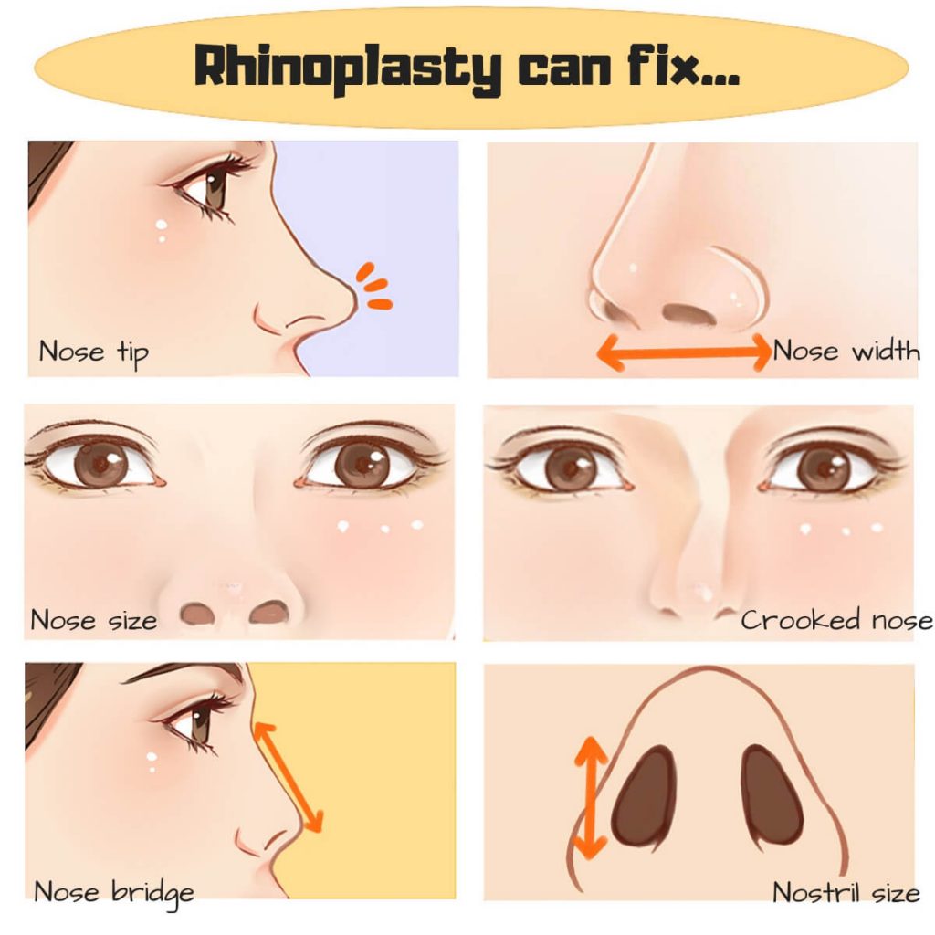 pakistani-celebrities-before-and-after-nose-surgery-reviewit-pk