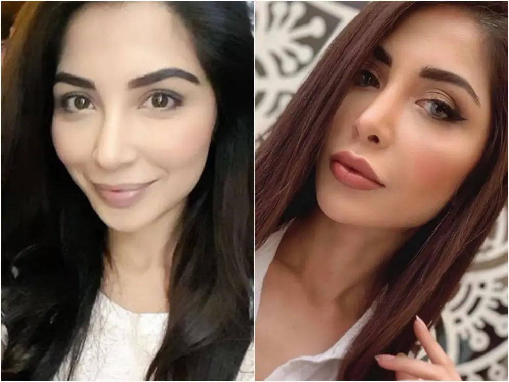 Pakistani Celebrities Before and After Nose Surgery