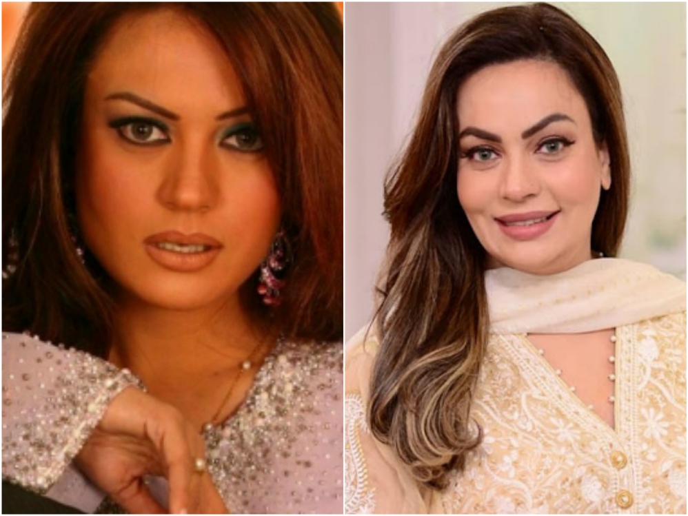 Pakistani Actresses Who Got Lip Fillers Done