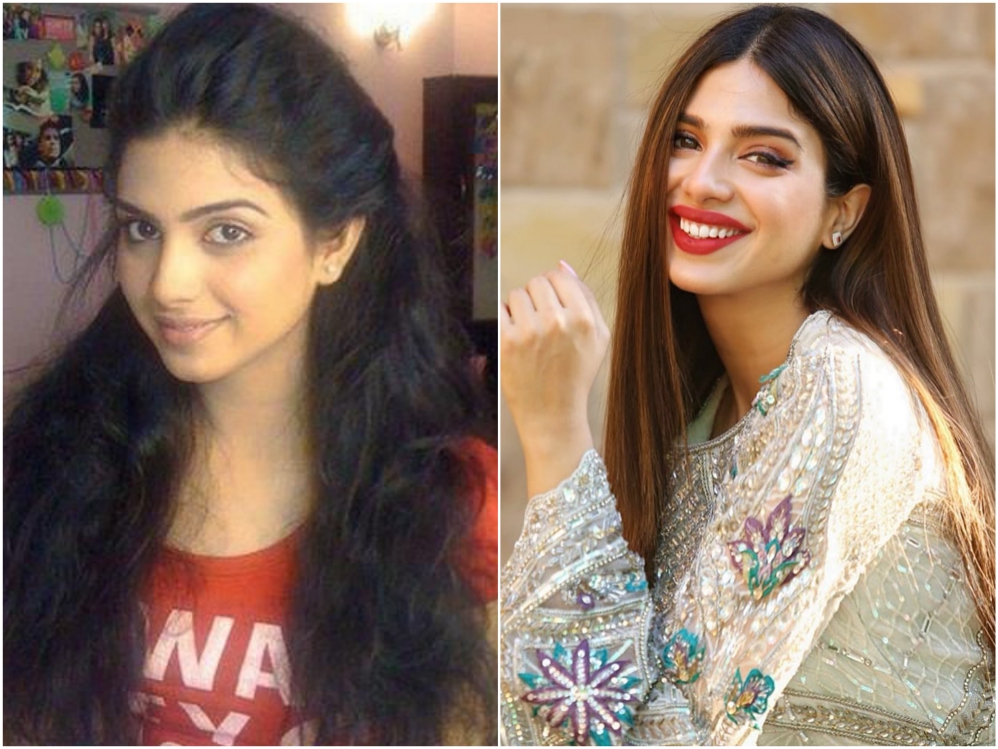 Pakistani Actresses Who Got Lip Fillers Done