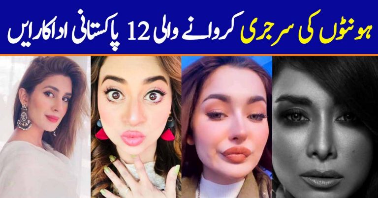 Pakistani Actresses Who Got Lip Fillers Done