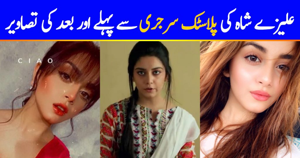 Alizeh Shah's Pictures Before And After Plastic Surgery