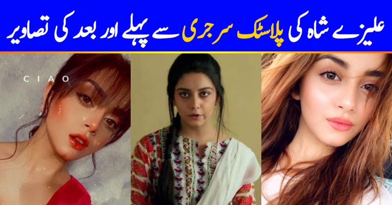 Alizeh Shah’s Pictures Before And After Plastic Surgery