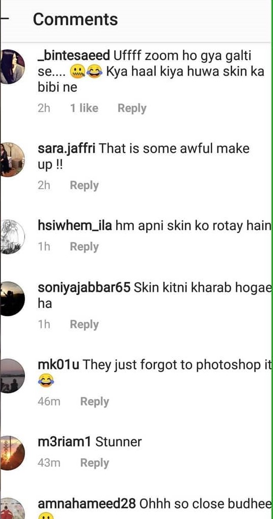 Syra Yousaf's Response After Public Criticism On Her Skin