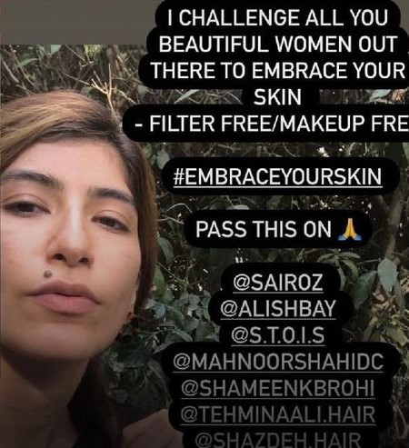 Syra Yousaf's Response After Public Criticism On Her Skin