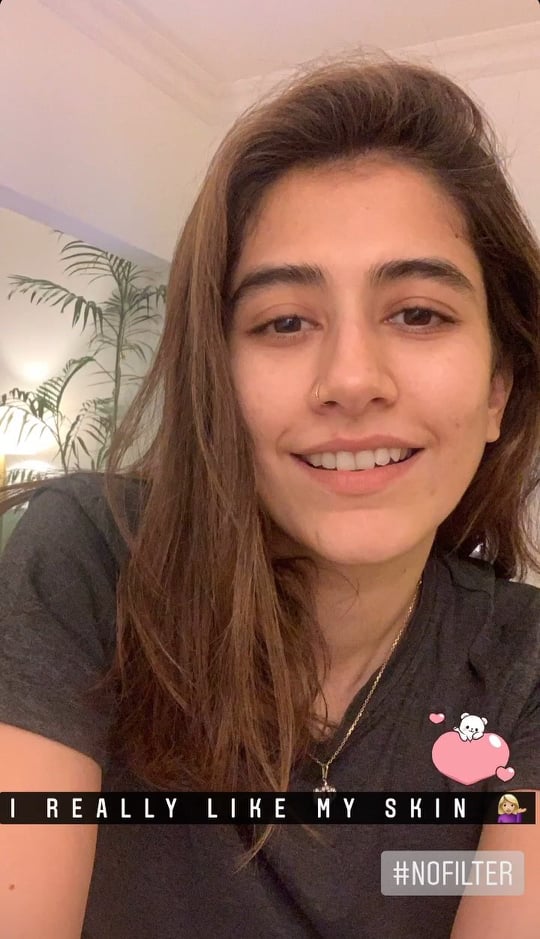 Syra Yousaf's Response After Public Criticism On Her Skin